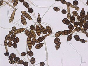 alternaria